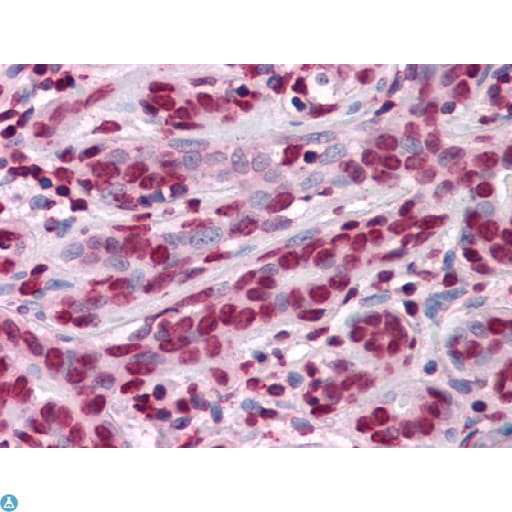 Monoclonal Mouse anti-Human ZBTB7B / HcKrox Antibody (IHC, IF, WB)