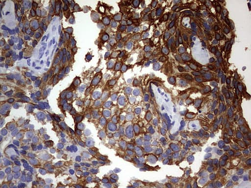 Monoclonal Mouse anti-Human KRT24 / Keratin 24 Antibody (clone OTI4E8, aa139-397, IHC, WB)