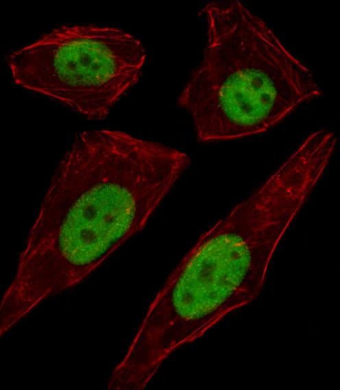 Polyclonal Rabbit anti-Human TFAP2D Antibody (aa308-336, IF, WB)