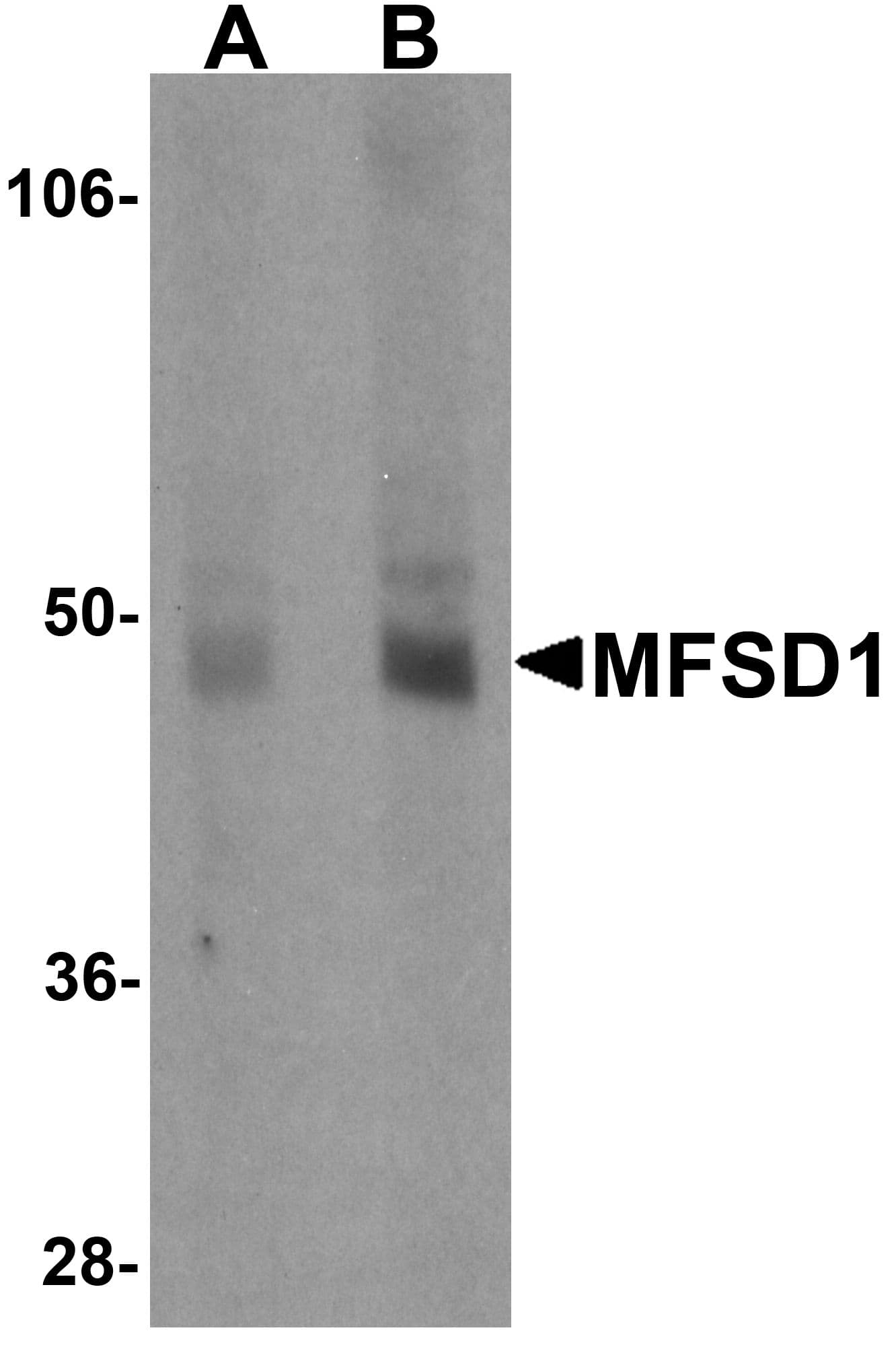 IHC-plus™ Polyclonal Rabbit anti-Human MFSD1 Antibody (IHC, WB)