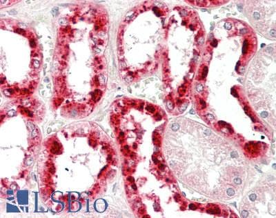 IHC-plus™ REN / Renin 1 Antibody (aa131-406, clone 2F10)