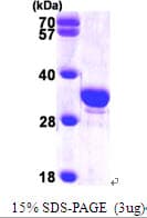 Human SCGN / Secretagogin Protein (Recombinant His)