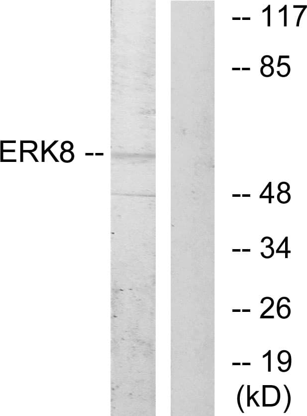 MAPK15 / ERK7 Antibody (aa141-190)
