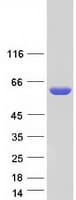 Human PNKP Protein (Recombinant Myc-DDK (Flag))