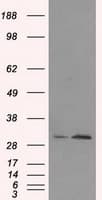 TIPRL / TIP Antibody (clone OTI3D11)