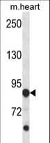STK9 / CDKL5 Antibody (aa730-758)