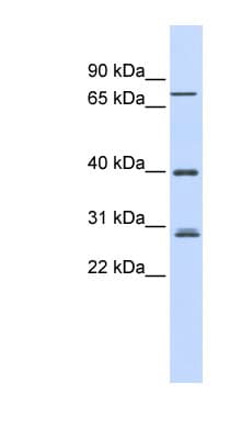 RNF6 Antibody (aa72-121)