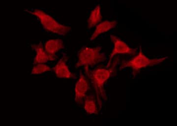 Polyclonal Rabbit anti-Human HTR6 / 5-HT6 Receptor Antibody (IF, WB)