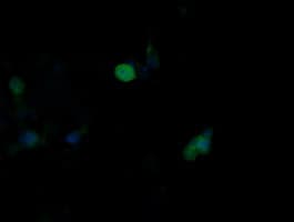 MAPK9 / JNK2 Antibody (clone OTI1A1)