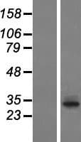 TAS2R60 Protein (Over-Expression Lysate Myc-DDK (Flag))