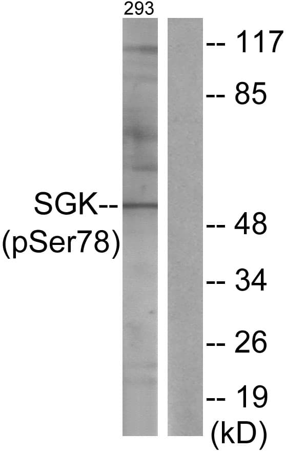 SGK1 / SGK Antibody (phospho-Ser78)