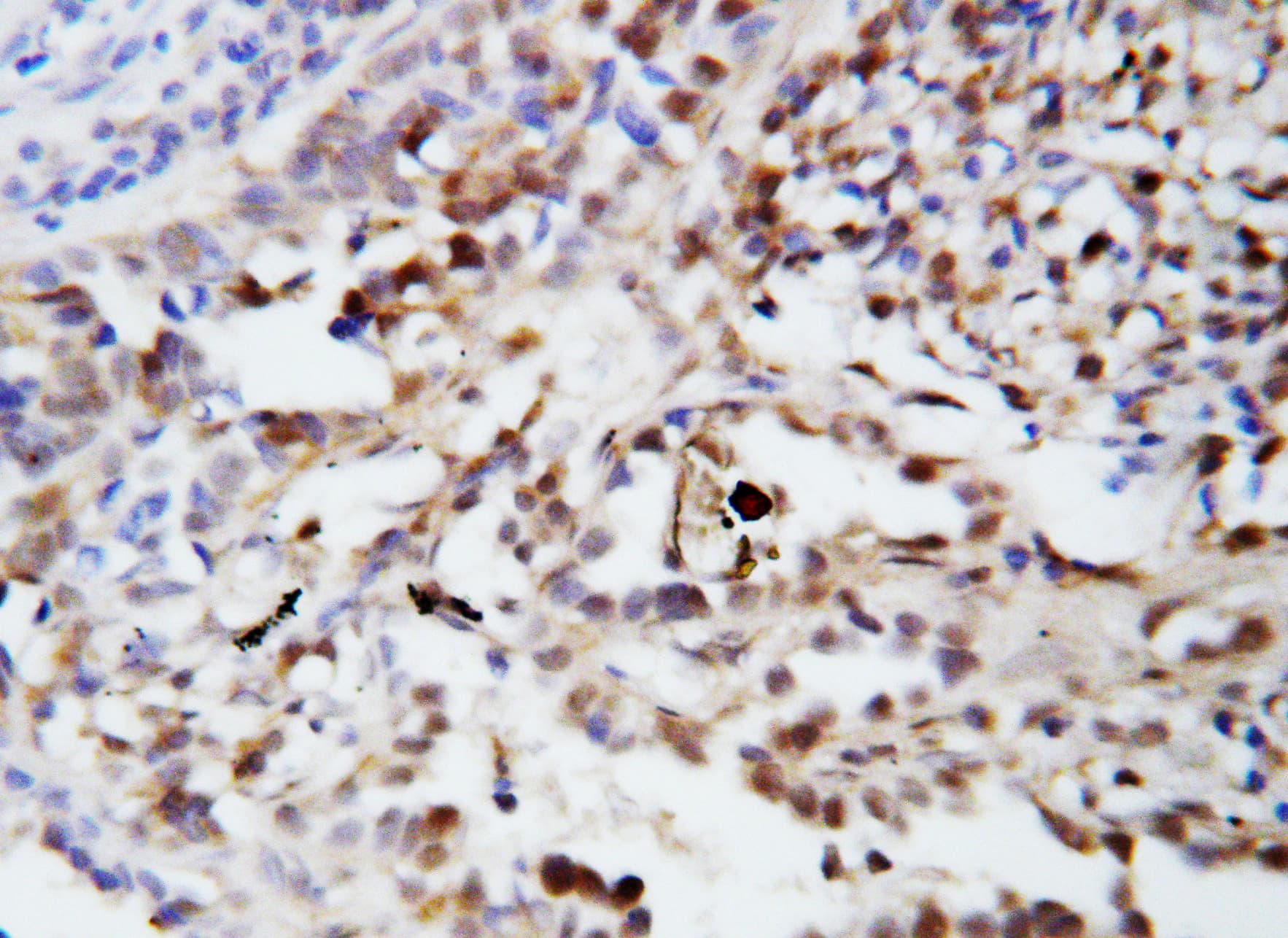 UBB / Ubiquitin B Antibody (aa29-45)