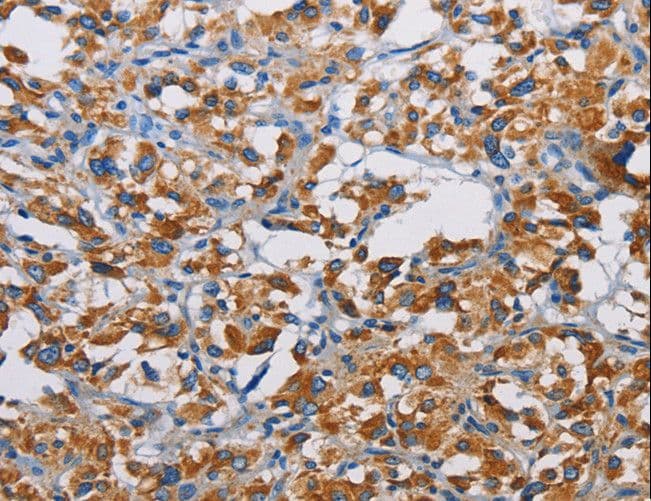 TSPEAR Antibody
