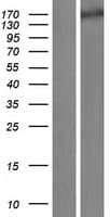 SLIT1 Protein (Over-Expression Lysate Myc-DDK (Flag))