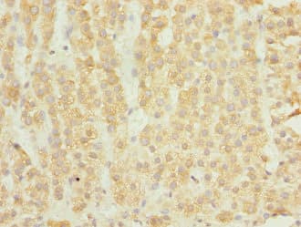 ELMOD1 Antibody