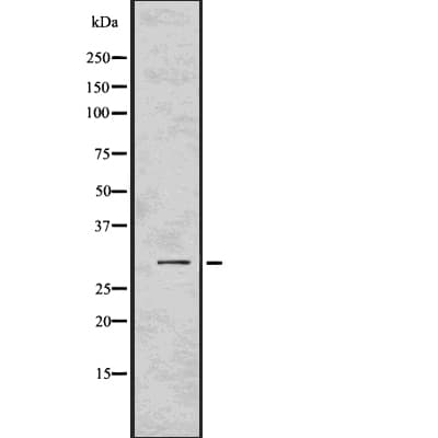 AQP2 / Aquaporin 2 Antibody