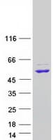 Human RNMTL1 Protein (Recombinant Myc-DDK (Flag))