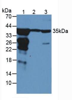 ARG1 / Arginase 1 Antibody (aa1-323, PE)