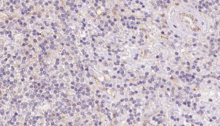 ACADVL Antibody