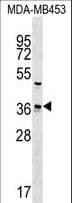 UBE2Z / USE1 Antibody (aa284-310)