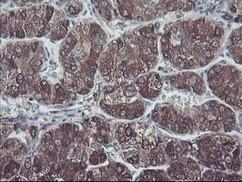 SH2D2A Antibody (clone OTI4F3)