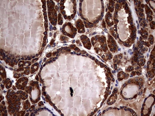 Monoclonal Mouse anti-Human GBA / Glucosidase Beta Acid Antibody (clone OTI4G4, aa40-315, IHC, WB)