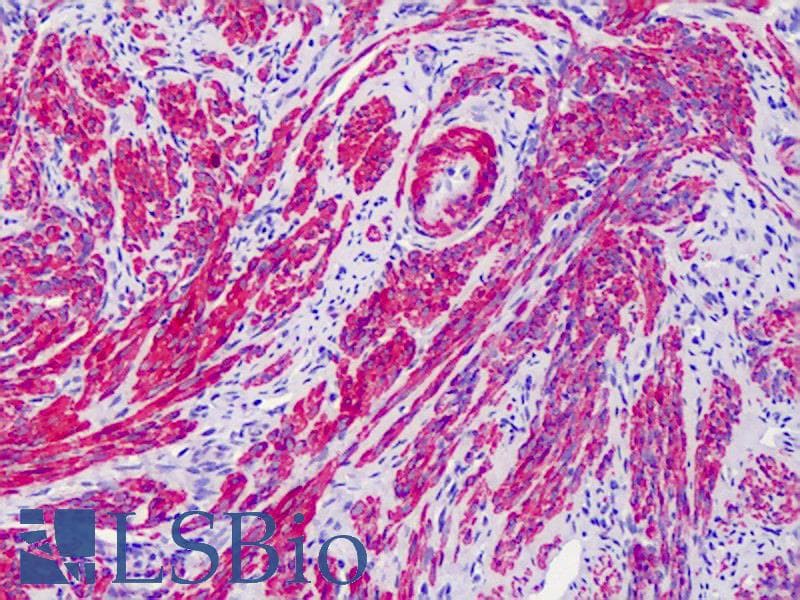 PathPlus™ ACTG2 Antibody (aa1-50)