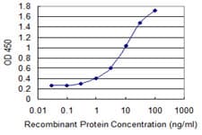 ALDH9A1 Antibody (clone 3C6)