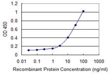 CD1B Antibody (clone 2E4)
