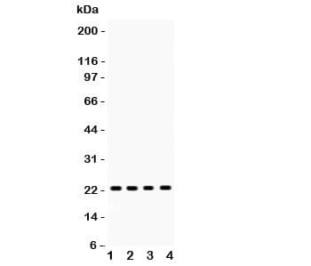 RBP4 Antibody (aa19-201)