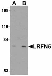 Polyclonal Rabbit anti-Human LRFN5 Antibody (IHC, WB)