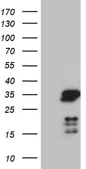 Monoclonal Mouse anti-Human NABP1 / OBFC2A Antibody (clone OTI8E3, WB)