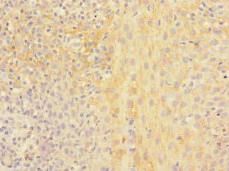 CHRNA2 Antibody