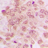 CDK2 Antibody (C-Terminus)