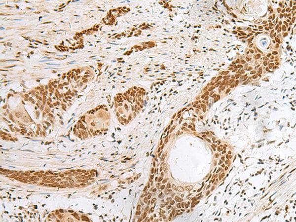 Polyclonal Rabbit anti-Human PNRC2 Antibody (IHC)