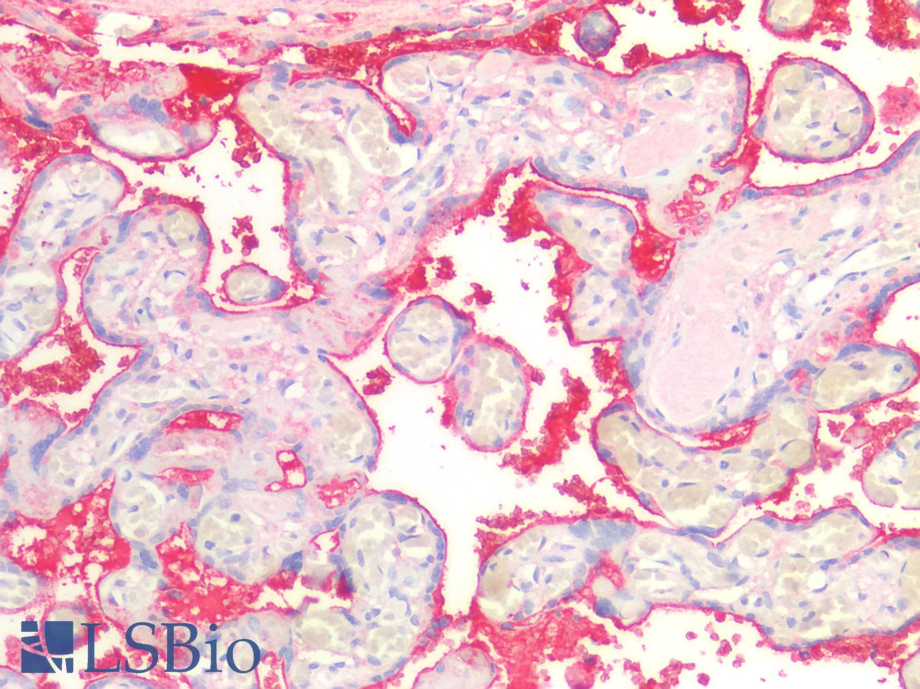 IHC-plus™ Monoclonal Mouse Anti-Human IgA Secondary Antibody (clone NI 69 (A89-034) and NI 184 (A89-035), IHC, IF)
