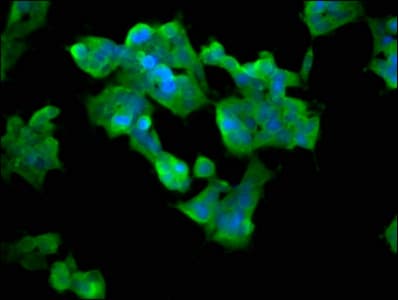 ASMT / HIOMT Antibody