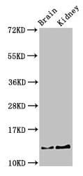 PVALB / Parvalbumin Antibody (aa2-110)