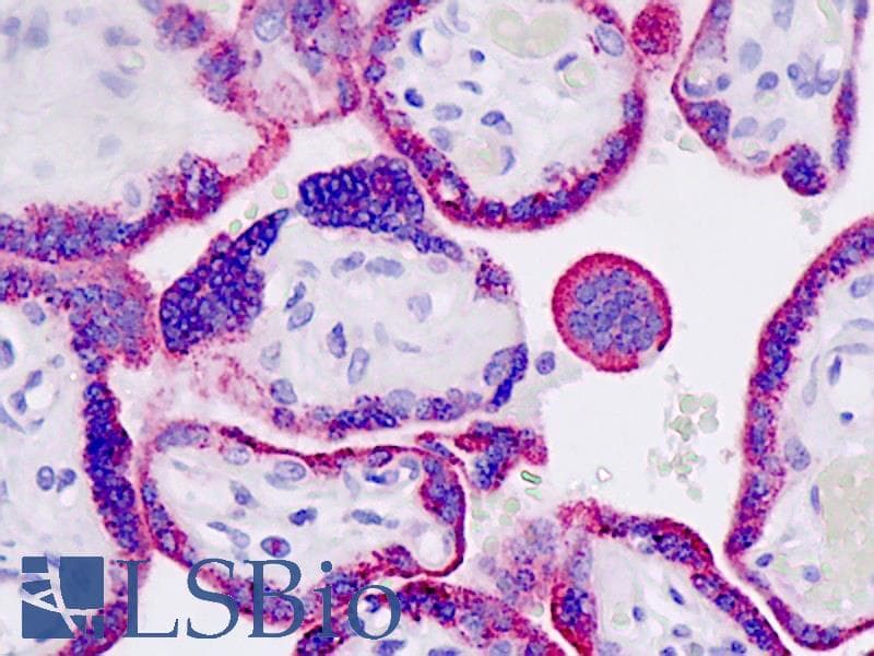 IHC-plus™ Polyclonal Rabbit anti-Mouse MAP4K3 / GLK Antibody (aa501-529, IHC, WB)