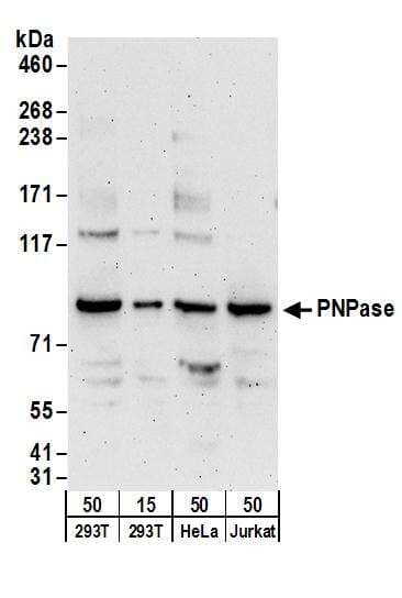 IHC-plus™ Polyclonal Rabbit anti-Human FBL / FIB / Fibrillarin Antibody (aa271-321, IHC, WB)