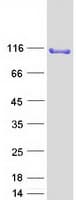 Human SND1 Protein (Recombinant Myc-DDK (Flag))