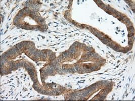 ERIC-1 / TACC3 Antibody (clone OTI1E4)