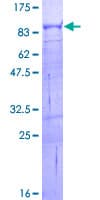 Human GSTCD Protein (Recombinant GST)