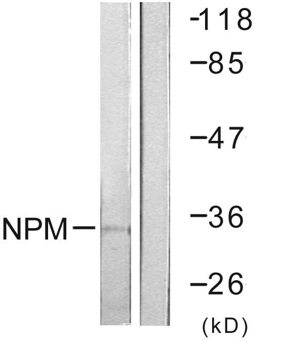 NPM1 / NPM / Nucleophosmin Antibody (aa171-220)