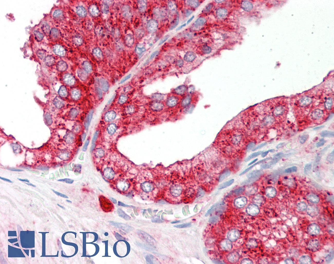 Polyclonal Rabbit anti-Human CLTA / LCA Antibody (aa141-190, IHC, WB)