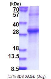 Human KLK11 / Kallikrein 11 Protein (Recombinant)