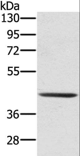 SCPEP1 / RISC Antibody