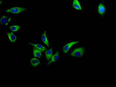 AVPR1A / V1a Receptor Antibody