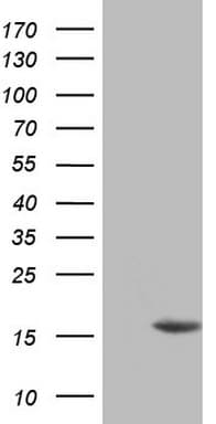p16INK4a / CDKN2A Antibody (clone OTI2H7)