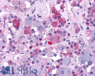 PathPlus™ AVPR1B Antibody (N-Terminus)